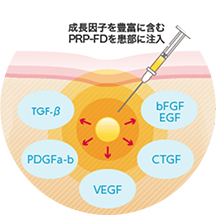 イメージ:PRP-FD(血小板血漿フリーズドライ)注射